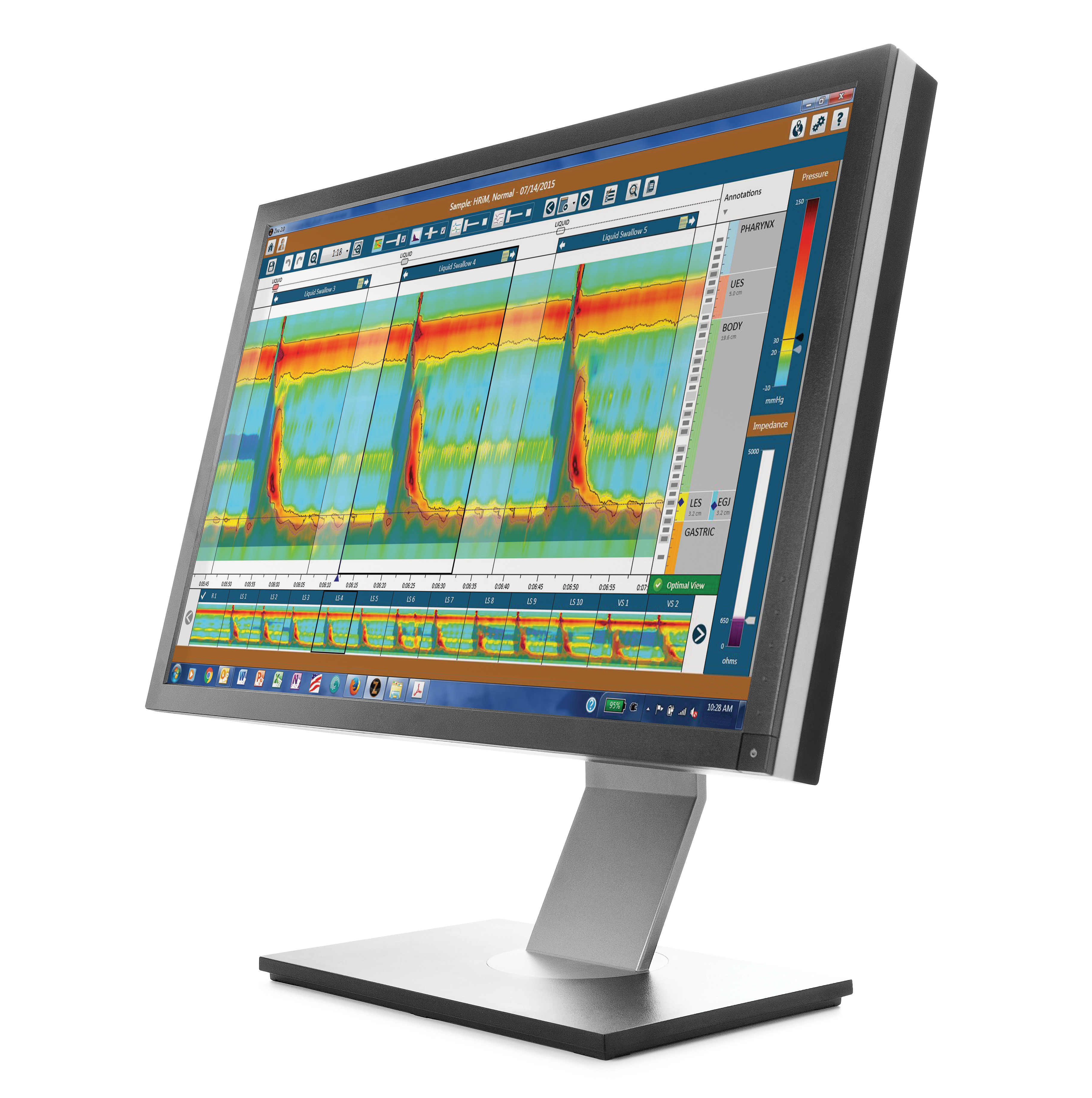 DIV1-46_Esophageal-new-screen-rezzed